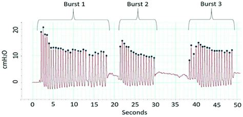 Example Non Nutritive Suck Nns Bursts Infant Nns Is Arranged In