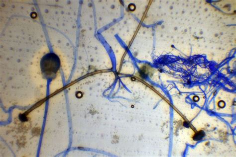 Rhizopus Stolonifer Under Microscope