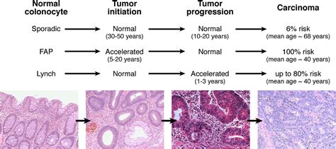 Genomic And Epigenetic Instability In Colorectal Cancer Pathogenesis