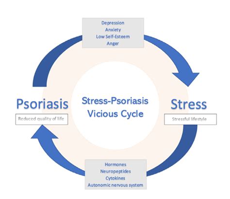 Psoriasis Common Triggers And How To Avoid Them Spring Of Science