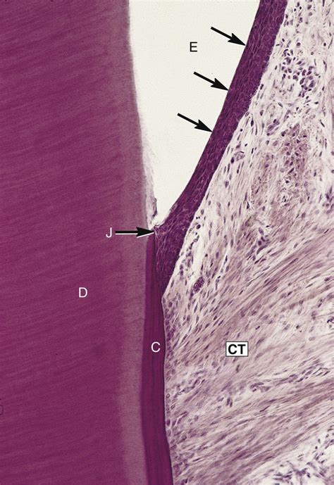 Initial Junctional Epithelium Diagram Quizlet