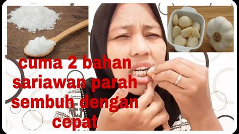 Obat Herbal Alami Yang Ampuh Menyembuhkan Sariawan Parah Dengan Cepat