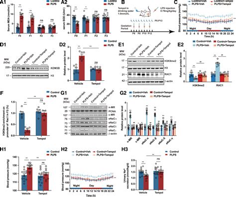 Prenatal Lipopolysaccharides Exposure Induces Transgenerational