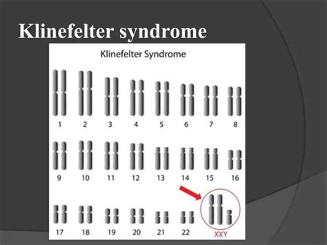 Karyotype &idiogram | PPT