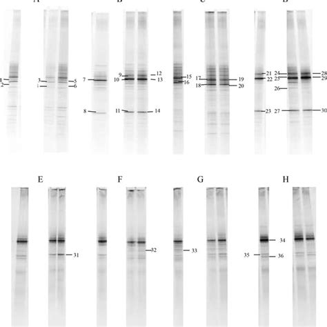 Denaturing Gradient Gel Electrophoresis Dgge Electrophoresis Of 16s