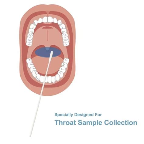 Monkeypox Virus Test Flocked Nasal Nasopharyngeal Swabs Vtm Specimen