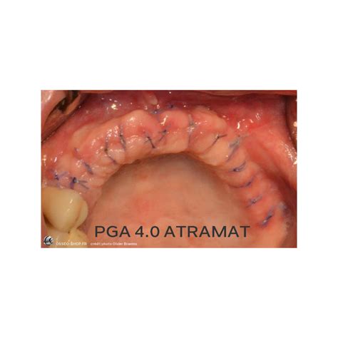 Sutures Dentaire Pga Atramat Bo Te De Fils Ttc