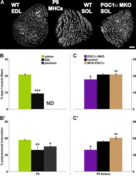 Fiber Type Composition Of Target Muscles Influences The Timing Of