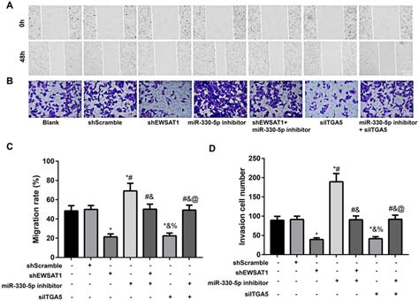 Wound Healing Test And Transwell Assay To Detect The Migration And