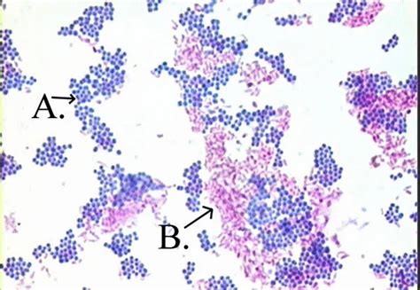 Acid Fast Stain Principle Procedure Interpretation And Examples