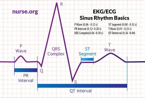 10 QRS Complex ideas | qrs complex, nursing notes, cardiac nursing