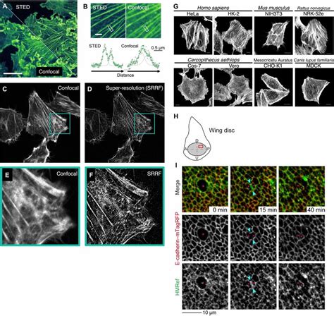 HMRef As A Fluorescent Probe For F Actin A STED Imaging Of Living