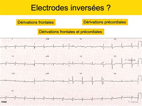 Th Mes Page Sur E Cardiogram