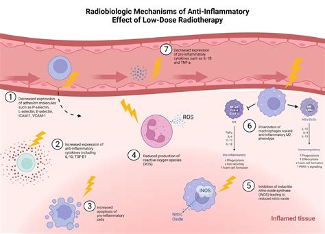 The Use Of Low Dose Radiation Therapy In Osteoarthritis A Review