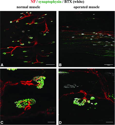 Whole Mount Staining Reveals Functional Connectivity Of The NMJs And