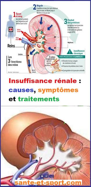 Insuffisance R Nale Causes Sympt Mes Et Traitements Sport Et Sant