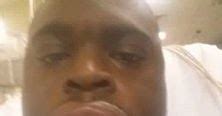 Welcome To Icechuks Blog Guy Lands In Hospital With Swollen Lip After Giving Oral Sex To Woman