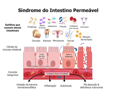 DISBIOSE INTESTINAL Sintomas O que é Tratamento BR