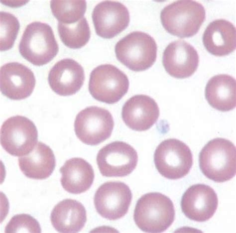 Diagnostics RBC WBC Morphology Flashcards Quizlet