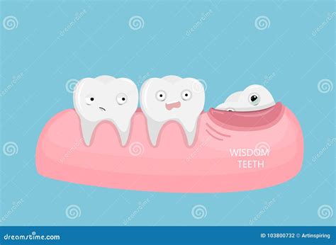 Wisdom Teeth Illustration Stock Vector Illustration Of Molar 103800732