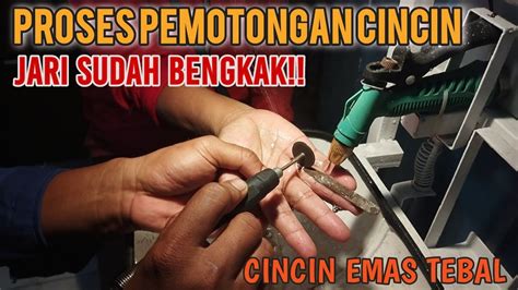 PEMOTONGAN CINCIN EMAS DI JARI YANG SUDAH BENGKAK OLEH PETUGAS DAMKAR