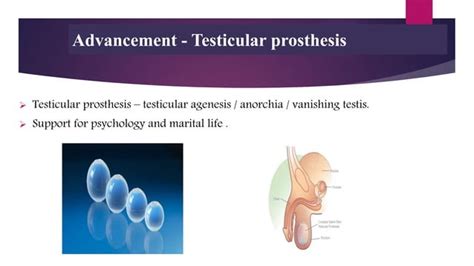 Empty Scrotum Ppt