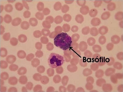 Basófilos Baixos O Que Significa - Basófilos bajos, ¿qué enfermedades produce? - Revista PEM