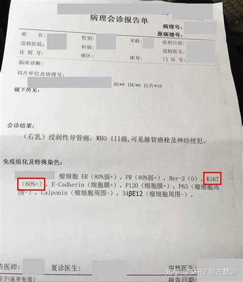 一文读懂乳腺癌的病理报告 知乎