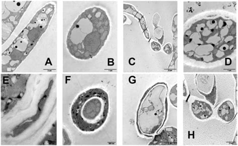 Transmission Electron Micrographs Tem Of P Infestans Hyphae In