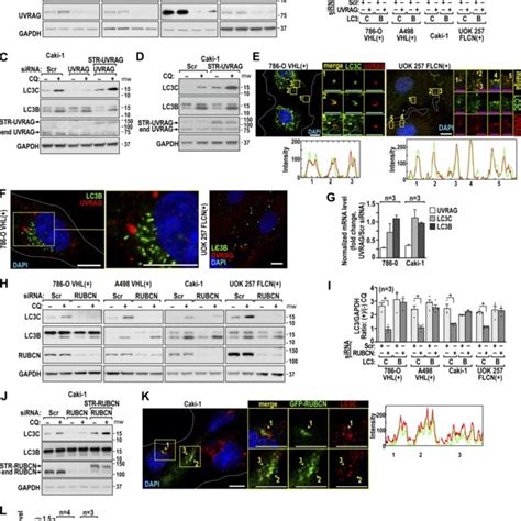 ULK3 Is Needed For LC3C Autophagy In RCC Cells A Immunoblots Show A