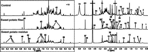 Typical One Dimensional 1 H Nmr Spectra Of Urine Metabolites Obtained Download Scientific