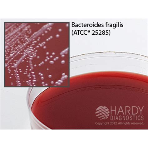 Hardy Diagnostic A62 Dry Culture Media Neomycin Anaerob Bld Agar Plate