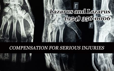 South Florida Injury Lawyers Lazarus And Lazarus