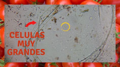 Celulas De Tomate Al Microscopio Sorprendente YouTube