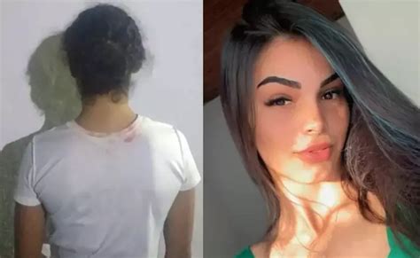 VÍDEO Mulher é presa suspeita de ter atacado jovem ácido por