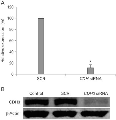 cdh sirna specifically knock downed cdh expression level