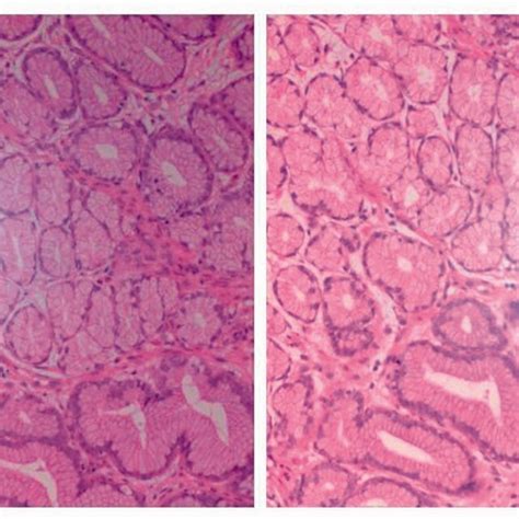 Histology Haematoxylin And Eosin Hande Staining ×40 Of The Gastric