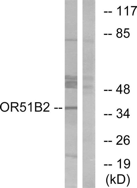 OR51B2 Polyclonal Antibody Invitrogen 100 μg Unconjugated Antibodies