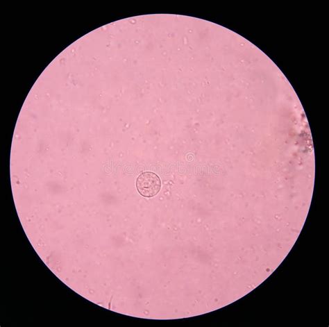 Entamoeba Coli Under Microscope