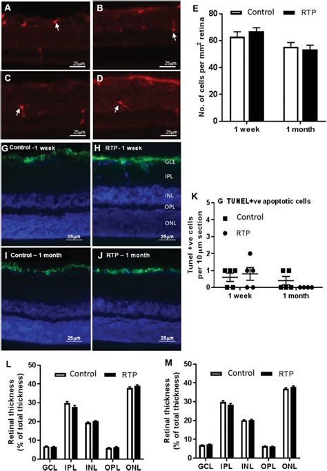 Detection Of Iba Gfap And Tunel Positive Cells In Retinal Sections