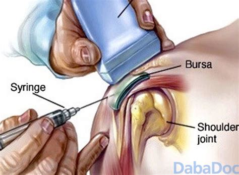 Dr Ali Kader Yettefti Chirurgien Orthop Diste Et Traumatologue