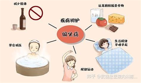 偏头痛应该看哪个科？你有没有挂错科室？ 知乎