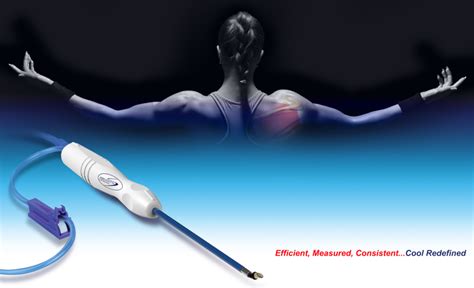 Velox™ Rf Wand Velocity Orthopedics Product Development