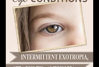 Intermittent Exotropia: Considering Surgery - Paperblog