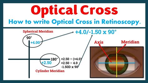 Optical Cross In Refraction Youtube