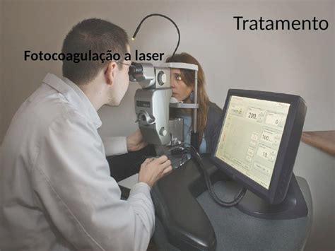 PPT Tratamento Fotocoagulação a laser Selamento do extravasamento