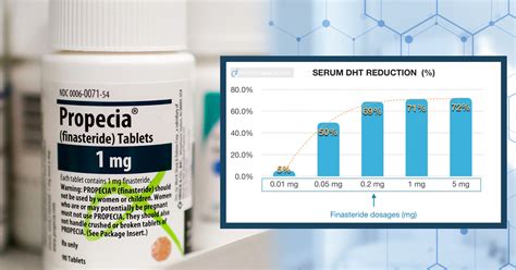 Finasteride Dosage for Hair Loss - Perfect Hair Health