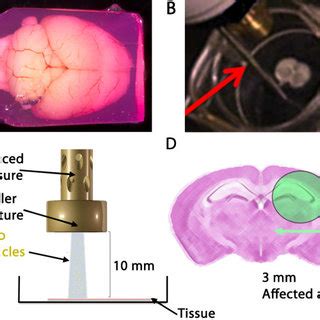 Adult Organotypic Brain Slice Preparation And Biolistic Transfection