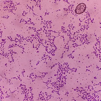 Microscopic View Of Enterococcus Bacteria From Uti Patient Urine Sample Show Grampositive Cocci ...