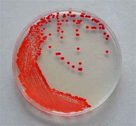 Think Pink – Serratia marcescens strikes again - Harper Water